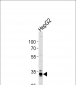 MPST Antibody (N-term)